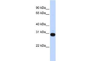 WB Suggested Anti-VASH1 Antibody Titration: 0. (VASH1 anticorps  (Middle Region))