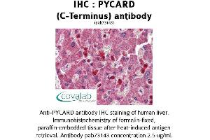 Image no. 1 for anti-PYD and CARD Domain Containing (PYCARD) (C-Term) antibody (ABIN1738638) (PYCARD anticorps  (C-Term))