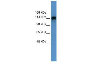 WB Suggested Anti-PITPNM1 Antibody Titration: 0. (PITPNM1 anticorps  (N-Term))