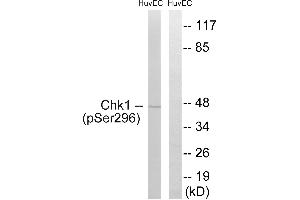 Immunohistochemistry analysis of paraffin-embedded human brain tissue using Chk1 (Phospho-Ser296) antibody. (CHEK1 anticorps  (pSer296))