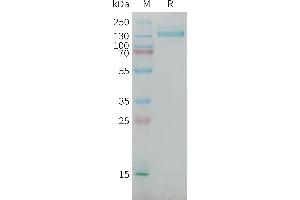 Human C(1538-2221) Protein, mFc Tag on SDS-PAGE under reducing condition. (NG2 Protein (AA 1538-2221) (mFc Tag))