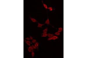 ABIN6274858 staining LOVO by IF/ICC. (Apolipoprotein L 4 anticorps)