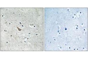 Immunohistochemistry analysis of paraffin-embedded human brain, using Ephrin B1/B2 (Phospho-Tyr329) Antibody. (Ephrin B1/B2 (AA 295-344), (pTyr329) anticorps)