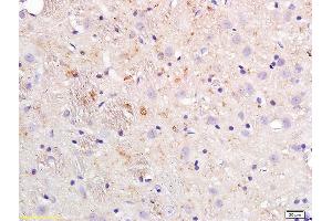 Formalin-fixed and paraffin embedded rat brain tissue labeled with Anti-APOE4/Apolipoprotein E4 Polyclonal Antibody, Unconjugated (ABIN708746) at 1:200 followed by conjugation to the secondary antibody (APOE anticorps  (AA 101-200))