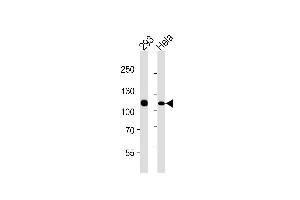 Lane 1: 293 Cell lysates, Lane 2: HeLa Cell lysates, probed with MSH2 (1184CT1. (MSH2 anticorps)