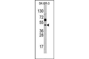 Image no. 1 for anti-Tumor Protein P53 (TP53) (C-Term) antibody (ABIN358757) (p53 anticorps  (C-Term))