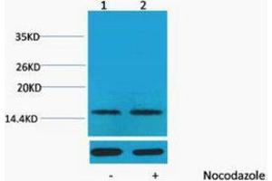 Western Blotting (WB) image for anti-Histone H1 (pThr17) antibody (ABIN3181350) (Histone H1 anticorps  (pThr17))