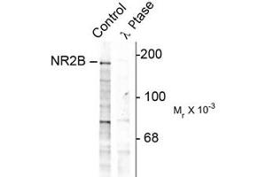 Image no. 1 for anti-Glutamate Receptor, Ionotropic, N-Methyl D-Aspartate 2B (GRIN2B) (pTyr1252) antibody (ABIN303962) (GRIN2B anticorps  (pTyr1252))