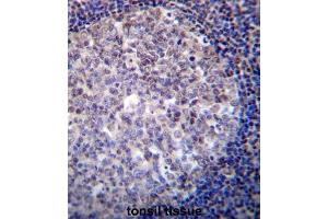 Immunohistochemistry (IHC) image for anti-Recombination Activating Gene 2 (RAG2) antibody (ABIN2996750) (RAG2 anticorps)