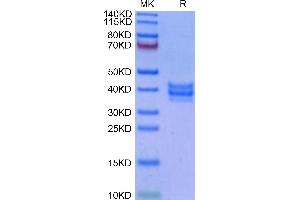 Cynomolgus NKG2C&CD94 on Tris-Bis PAGE under reduced condition. (NKG2C & CD94 (AA 98-231) protein (His tag,DYKDDDDK Tag))