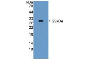 Western blot analysis of recombinant Human TNKS2. (TNKS2 anticorps  (AA 959-1166))