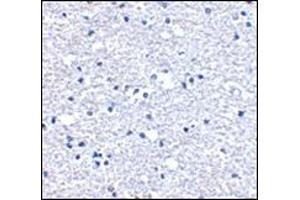 Immunohistochemistry of PD-1 in human brain tissue with this product at 5 μg/ml. (PD-1 anticorps  (Center))