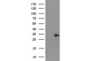 Western Blotting (WB) image for anti-Haloacid Dehalogenase-Like Hydrolase Domain Containing 2 (HDHD2) antibody (ABIN1498627) (HDHD2 anticorps)