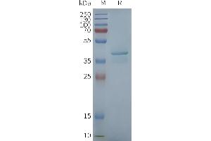 Human ST-Nanodisc, Flag Tag on SDS-PAGE (STING1 Protéine)