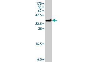 Western Blot detection against Immunogen (34. (S100A6 anticorps  (AA 18-90))