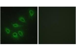 Immunofluorescence analysis of HeLa cells, using eNOS (Ab-1179) Antibody. (ENOS anticorps  (AA 1145-1194))