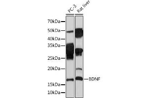 Western blot analysis of extracts of various cell lines, using BDNF Rabbit mAb (ABIN7265916) at 1:1000 dilution. (BDNF anticorps)