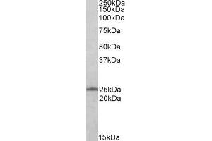 Western Blotting (WB) image for anti-RAN, Member RAS Oncogene Family (RAN) antibody (ABIN5876166) (RAN anticorps)