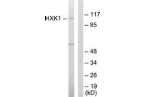 Western Blotting (WB) image for anti-Hexokinase 1 (HK1) (AA 31-80) antibody (ABIN2889414) (Hexokinase 1 anticorps  (AA 31-80))