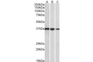 P31930PU-N TBP antibody staining of cell line NIH3T3 (A), Mouse Testis (B) and Rat Testis (C) lysates at 1 µg/ml (35µg protein in RIPA buffer). (TBP anticorps  (Internal Region))