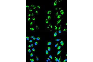 Immunofluorescence analysis of HeLa cell using NFKBIA antibody. (NFKBIA anticorps  (AA 1-317))