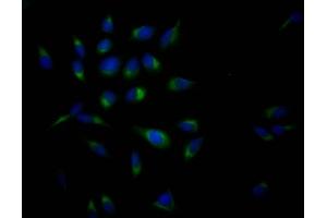 Immunofluorescence staining of Hela Cells with ABIN7127338 at 1:50, counter-stained with DAPI. (Recombinant APP anticorps)