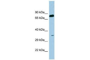 SDS antibody used at 1 ug/ml to detect target protein. (serine Dehydratase anticorps  (N-Term))