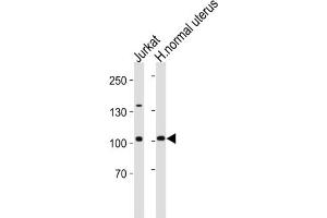 Western Blotting (WB) image for anti-Telomerase Reverse Transcriptase (TERT) antibody (ABIN2997736) (TERT anticorps)