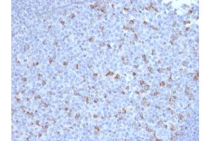 Formalin-fixed, paraffin-embedded human Tonsil stained with PD1 (CD279) Mouse Monoclonal Antibody (PDCD1/2720). (PD-1 anticorps)