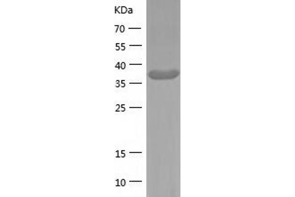 ADA Protein (AA 1-363) (His tag)