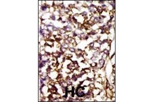 Immunohistochemistry (Paraffin-embedded Sections) (IHC (p)) image for anti-Cyclin-Dependent Kinase 4 (CDK4) (AA 273-305), (C-Term) antibody (ABIN391751)