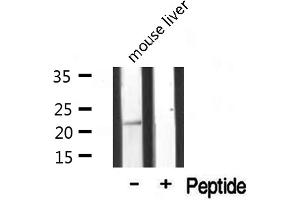 Western blot analysis of extracts from mouse liver, using MRPL20 antibody. (MRPL20 anticorps  (C-Term))