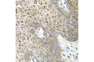 Immunohistochemistry of paraffin-embedded human esophagus using CDK1 antibody (ABIN6134274, ABIN6138303, ABIN6138304 and ABIN6219543) at dilution of 1:100 (40x lens). (CDK1 anticorps  (AA 208-258))