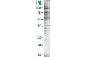 GPX8 transfected lysate. (GPX8 293T Cell Transient Overexpression Lysate(Denatured))