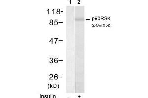 Image no. 1 for anti-Ribosomal Protein S6 Kinase, 90kDa, Polypeptide 1 (RPS6KA1) (pSer352) antibody (ABIN319222) (RPS6KA1 anticorps  (pSer352))