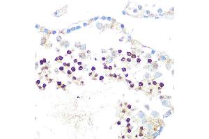Immunohistochemistry of paraffin-embedded rat testis using HP1 alpha/CBX5Rabbit mAb (ABIN1678748, ABIN3018030, ABIN3018031 and ABIN7101571) at dilution of 1:100 (40x lens). (CBX5 anticorps)