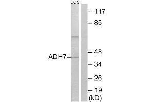 Western Blotting (WB) image for anti-Alcohol Dehydrogenase 7 (Class IV), mu Or sigma Polypeptide (ADH7) (Internal Region) antibody (ABIN1850713) (ADH7 anticorps  (Internal Region))