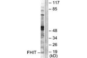 Western blot analysis of extracts from A549 cells, using FHIT Antibody. (FHIT anticorps  (AA 81-130))