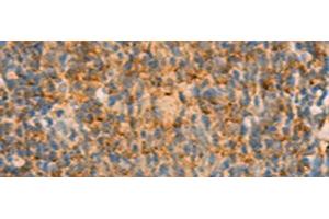Immunohistochemistry of paraffin-embedded Human tonsil tissue using IFITM2 Polyclonal Antibody at dilution of 1:25(x200) (IFITM2 anticorps)