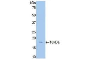 Detection of Recombinant CST3, Rat using Polyclonal Antibody to Cystatin C (Cys-C) (CST3 anticorps  (AA 21-140))