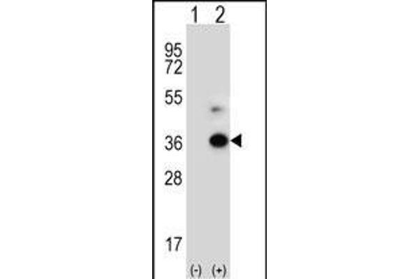 ANGPTL7 anticorps  (C-Term)