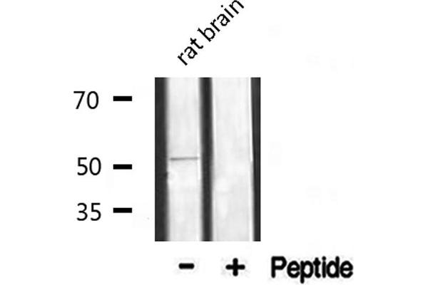 alpha 1 Adrenergic Receptor anticorps  (Internal Region)