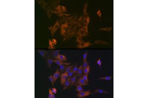 Immunofluorescence analysis of NIH/3T3 cells using LPP Rabbit mAb (ABIN7268284) at dilution of 1:100 (40x lens). (LPP anticorps)
