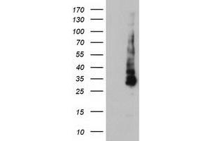Western Blotting (WB) image for anti-Potassium Inwardly-Rectifying Channel, Subfamily J, Member 3 (KCNJ3) (AA 279-501) antibody (ABIN1491313) (KCNJ3 anticorps  (AA 279-501))