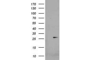 Western Blotting (WB) image for anti-Cyclin-Dependent Kinase Inhibitor 3 (CDKN3) antibody (ABIN1497458) (CDKN3 anticorps)