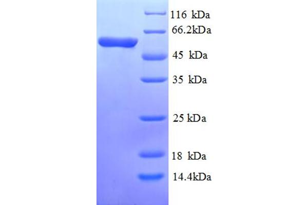 CDC25C Protein (AA 1-473, full length) (His tag)