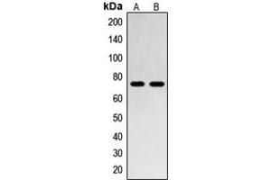 Western blot analysis of SENP1 expression in Jurkat (A), HL60 (B) whole cell lysates. (SENP1 anticorps  (N-Term))