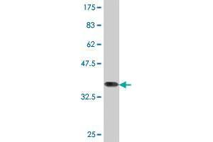 Western Blot detection against Immunogen (37. (NSD1 anticorps  (AA 2-109))