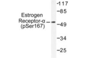 Image no. 1 for anti-Estrogen Receptor 1 (ESR1) (pSer167) antibody (ABIN318019) (Estrogen Receptor alpha anticorps  (pSer167))