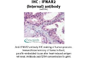 Image no. 2 for anti-Interferon alpha/beta Receptor 2 (IFNAR2) (Internal Region) antibody (ABIN1735773) (IFNAR2 anticorps  (Internal Region))